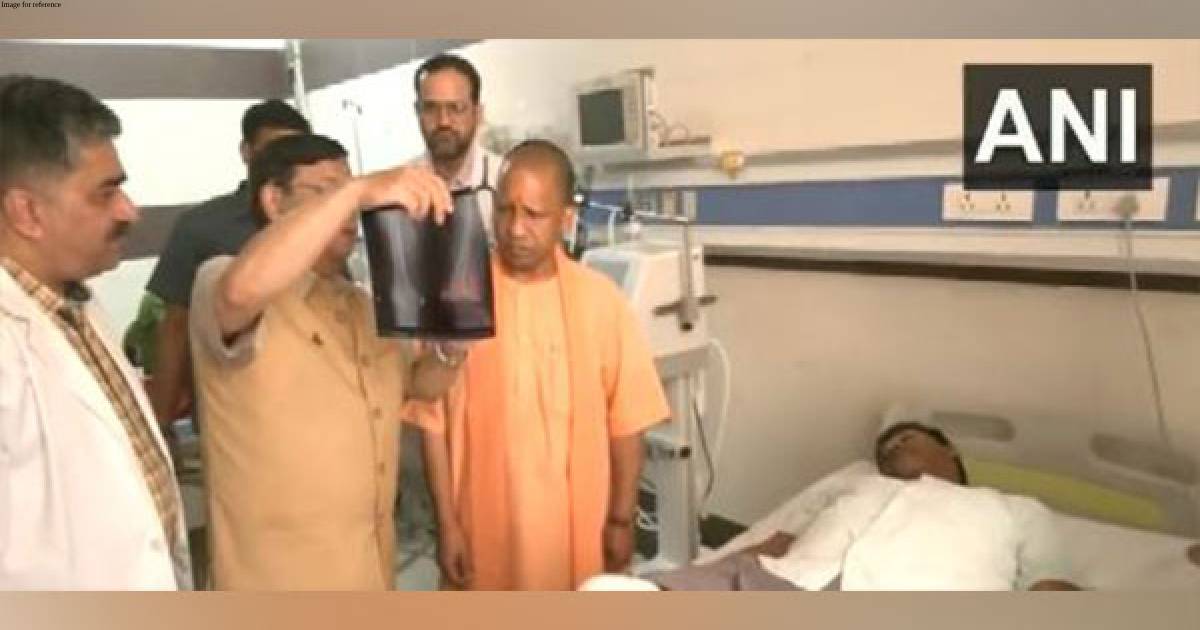 Lucknow court firing: CM Yogi meets injured in hospital